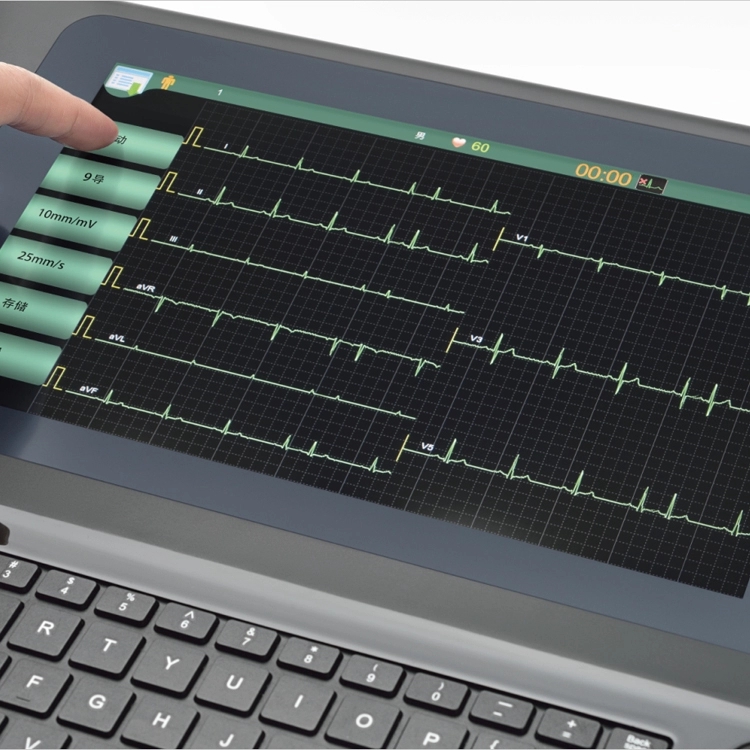 12-channel ECG-1212 electrocardiograph portable ECG machine-MeCan