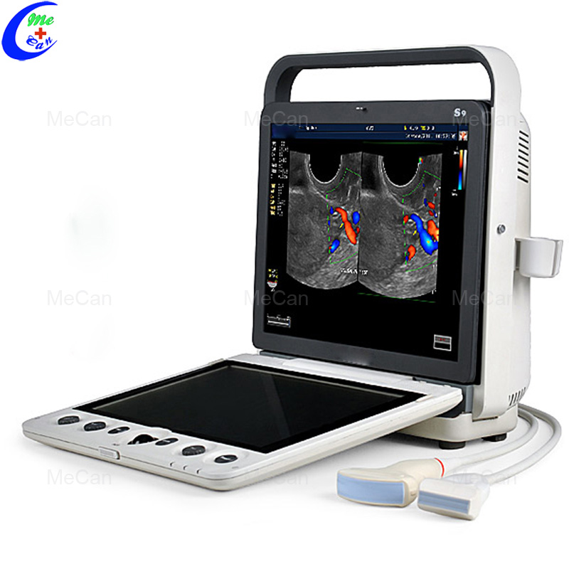 Sonoscape Portable Cardiovascular Ultrasound Machine MeCan