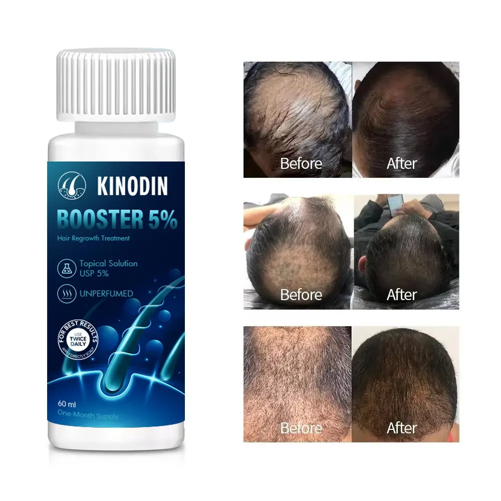 Professional Keratin Hair Mask Price List 4