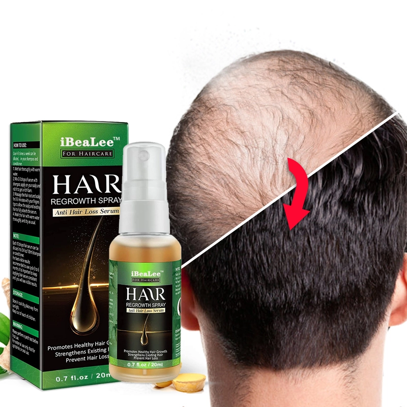 Ginger Essence Fast Hair Regrowth Serum for Men - Hair Growth & Scalp Treatment 1