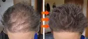 Factory Direct Biotin for Hair Growth 6