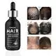 Hair Loss Products for Men Hair Treatment/Hair Growth by Kinodin 6