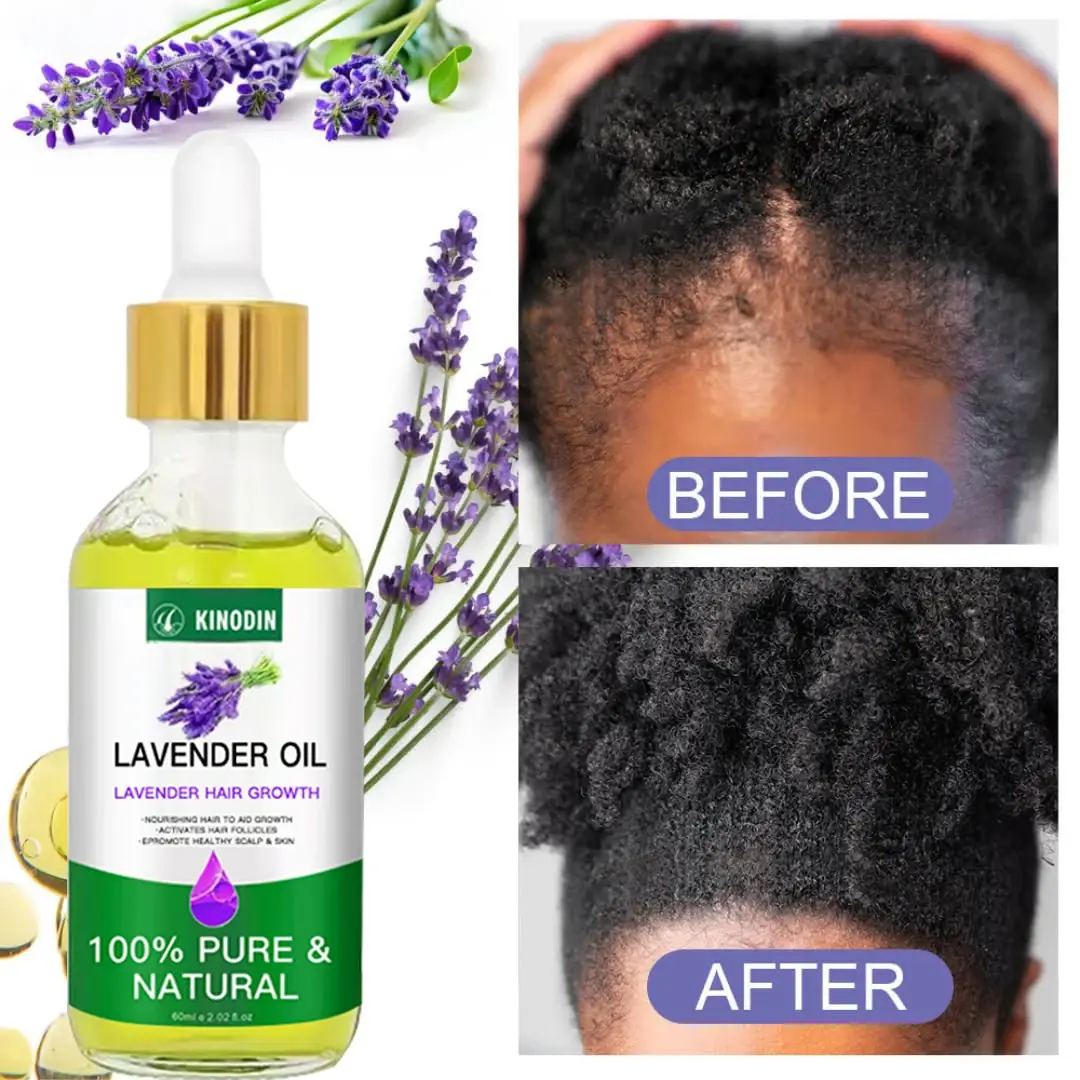 Hair Serum for Hair Growth Seeds Wholesale - Kinodin 5