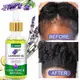 Hair Serum for Hair Growth Seeds Wholesale - Kinodin 5