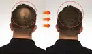 Kinodin Hair Styling Products for Home Usemanufacturing 6