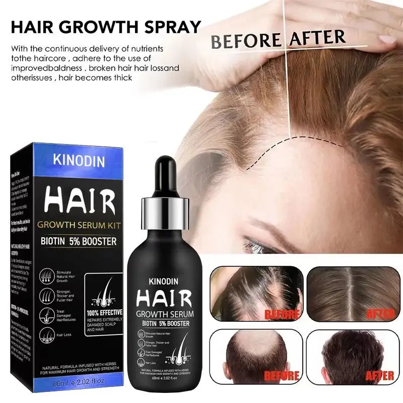 Hair Loss Products for Men Hair Treatment/Hair Growth by Kinodin 4