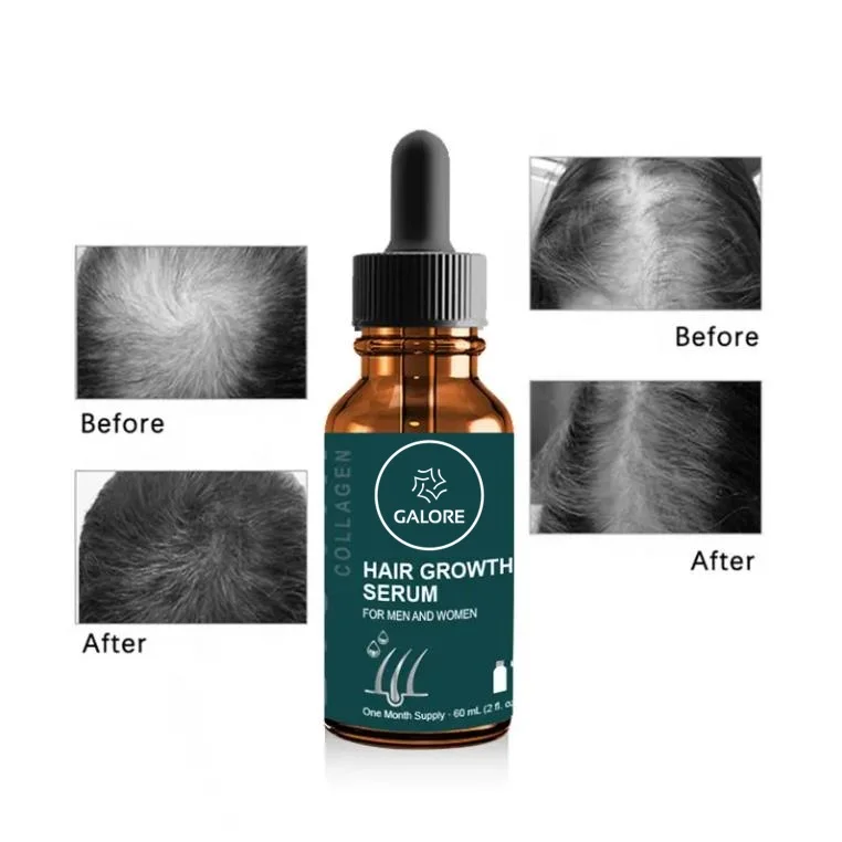 Serum Biotin Minyak Penumbuh Rambut Merek Pribadi 60ml 6
