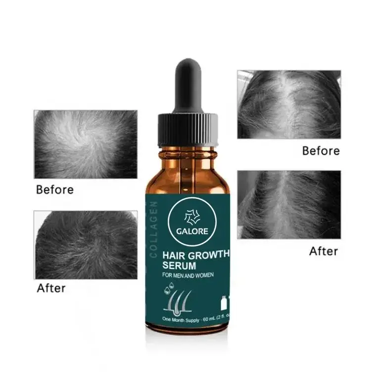 Hot Sale Natural Hair Growth Products 6
