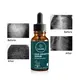 Hot Sale Natural Hair Growth Products 6