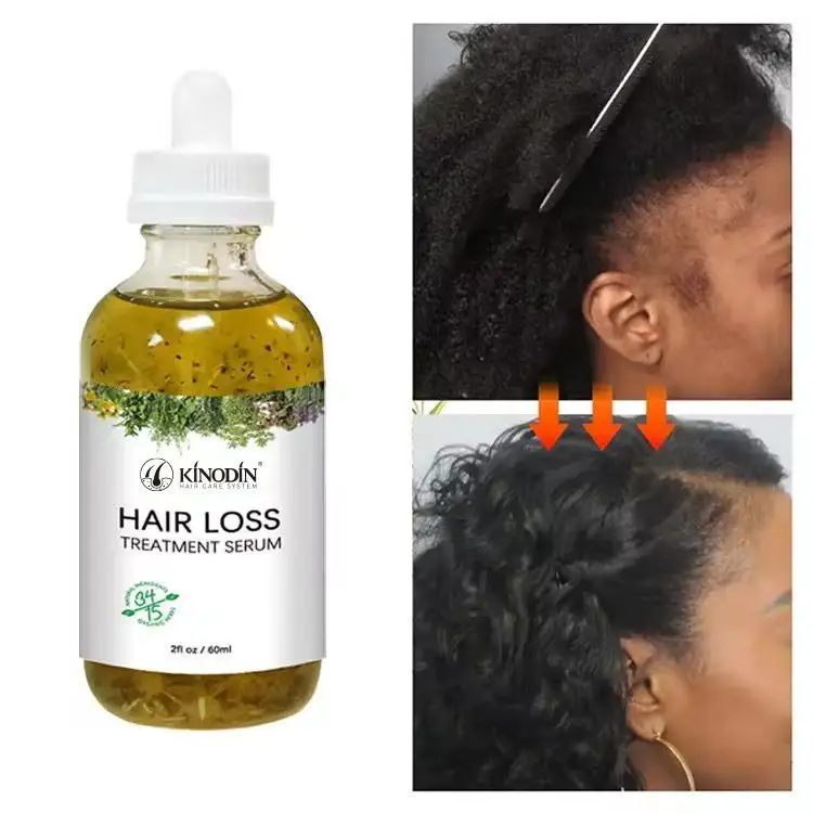 High End Tea Tree Scalp Treatment Price List 4