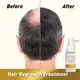 Cost-Effective Hair Treatment Products Price List 5