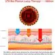 Quality UTK Brand Back H14S1 Infrared Heating Pads for Sale 5
