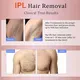 Custom Ipl Hair Removal Equipment Manufacturer Suppliers 5