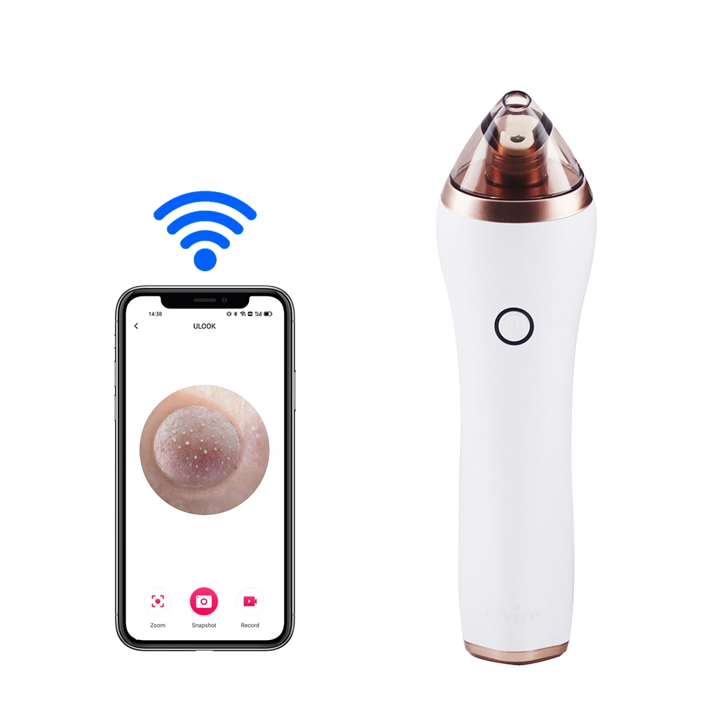 Görünür Vakumlu Siyah Nokta Giderici Cihaz Gözenek Temizleyici Comedo Exfoliator Wifi Bağlantılı 4 Yedek Başlık 4 Emme Ayarlanabilir Seviye 1