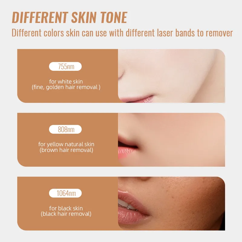 Portable 808 Diode Laser Hair Removal Machine Price 755 808 1064nm Diode Laser Hair Removal Machine-1 6