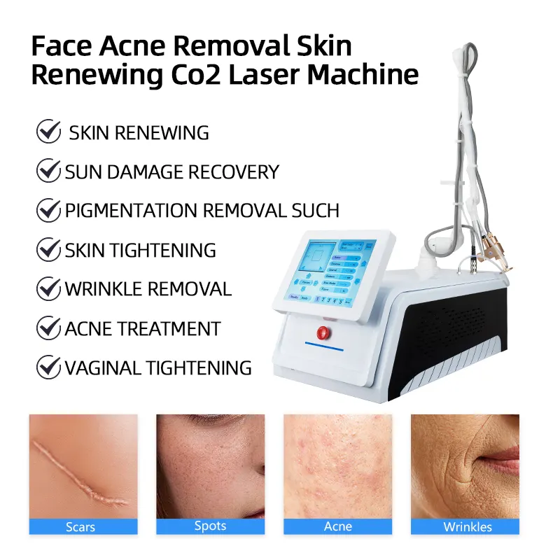 Lesen Beauty Laser Cosmetic Equipment Laser Cosmetic Equipmentmanufacturer 6