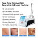Lesen Beauty Laser Cosmetic Equipment Laser Cosmetic Equipmentmanufacturer 6