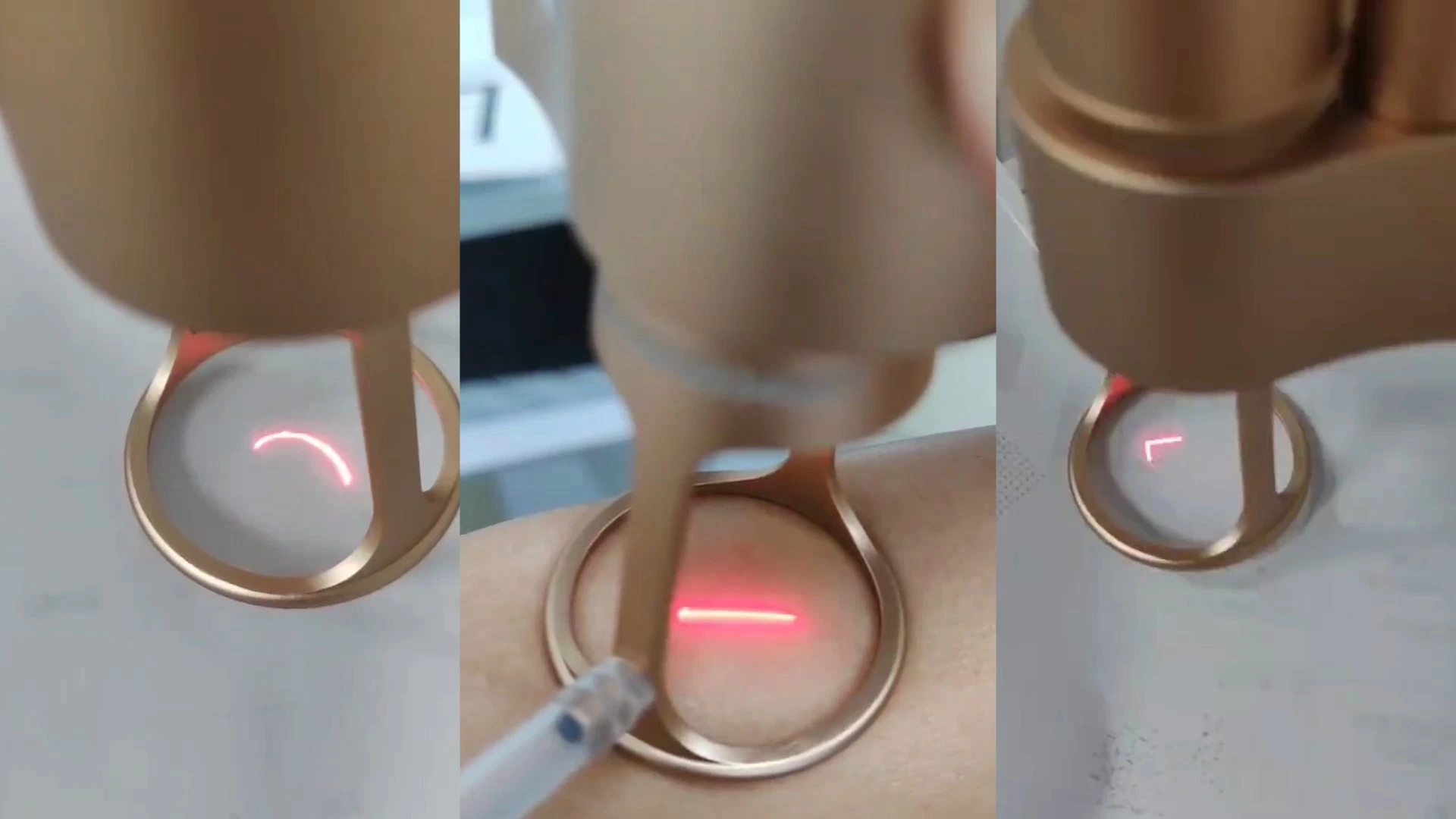 Máy Laser Co2 Fractional Tái tạo bề mặt da Máy Laser Co2 Fractional chuyên nghiệp giá rẻ 1
