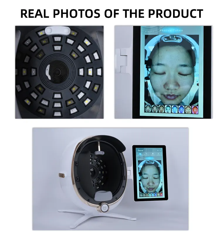 New Radio Frequency Skin Tightening Machine Supply for Personal Use 4