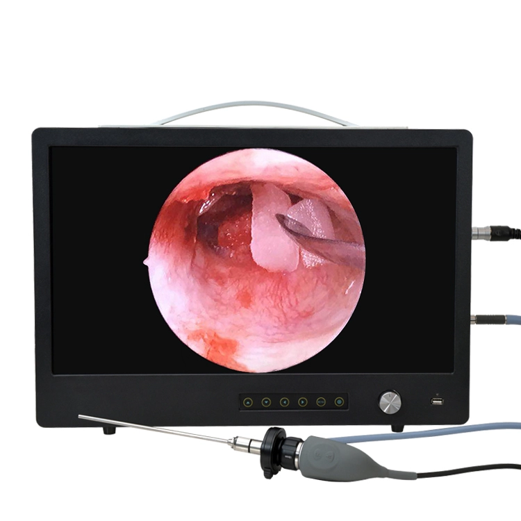 Full HD Portable ENT Endoscope Camera System INC-HDE22O | INNORKOM 1