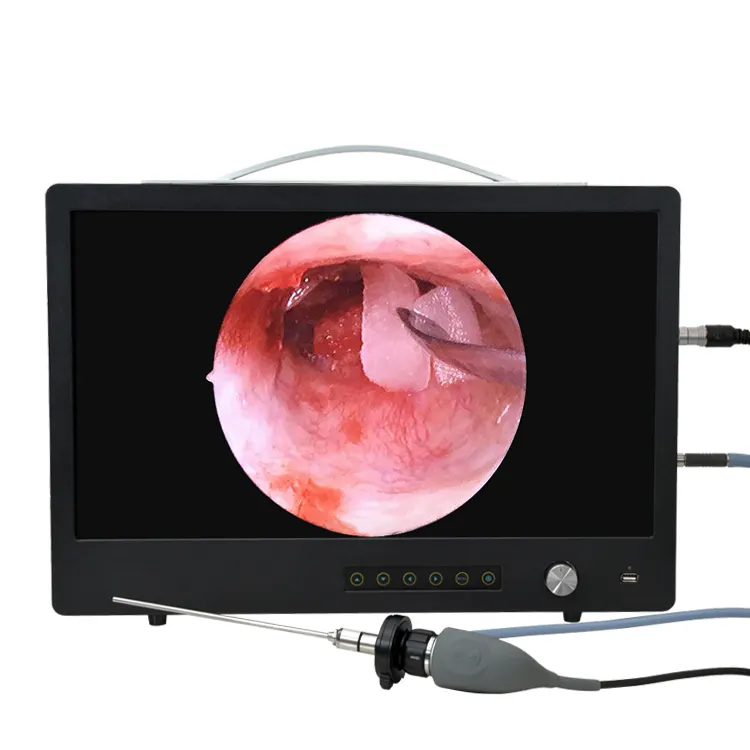 Máquina de endoscopia portátil: ¿Por qué a médicos y pacientes les encanta? 1