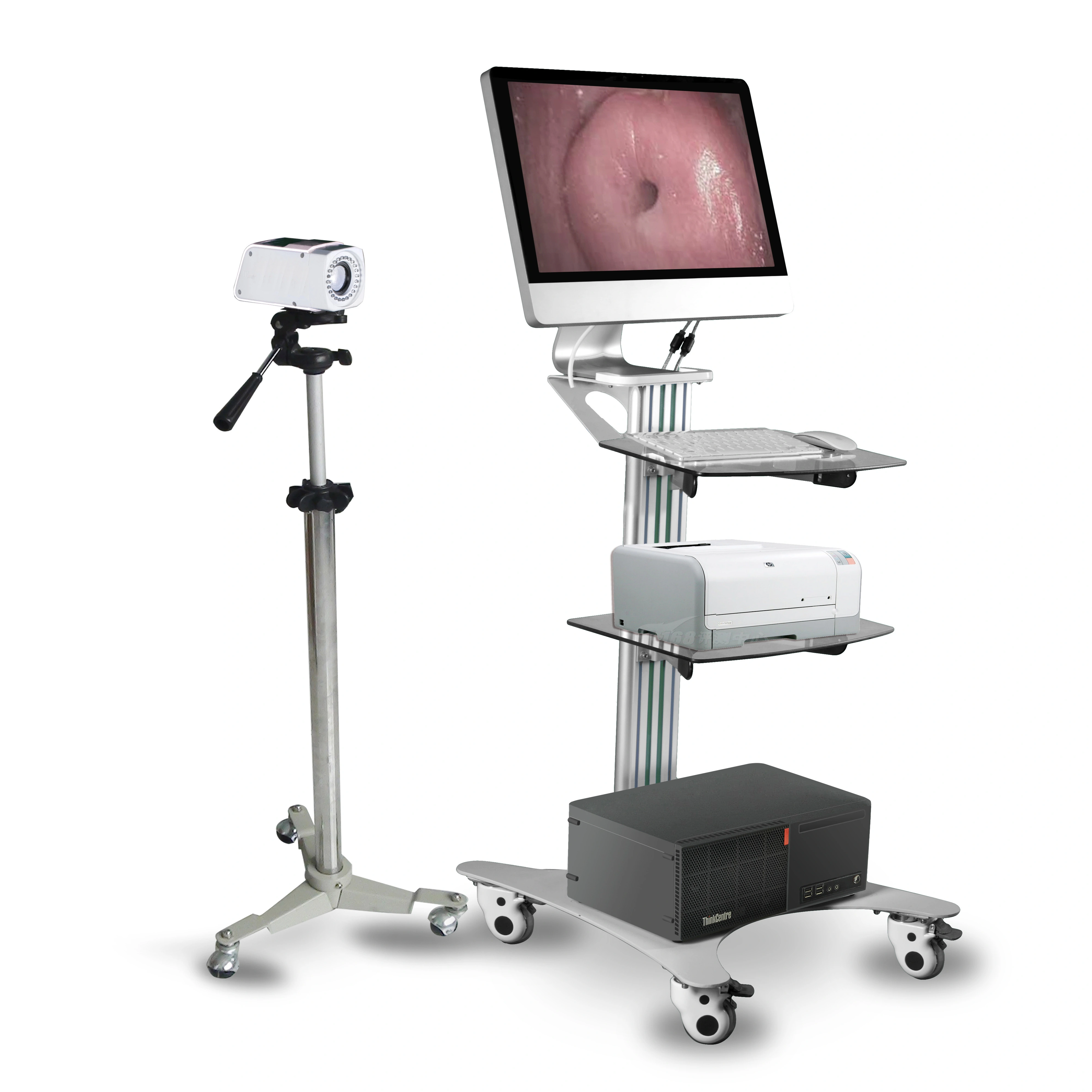 Vídeo Colposcópio Vaginal Digital Câmera Óptica Carrinho Portátil Máquina de Software de Vídeo | INORKOM 1