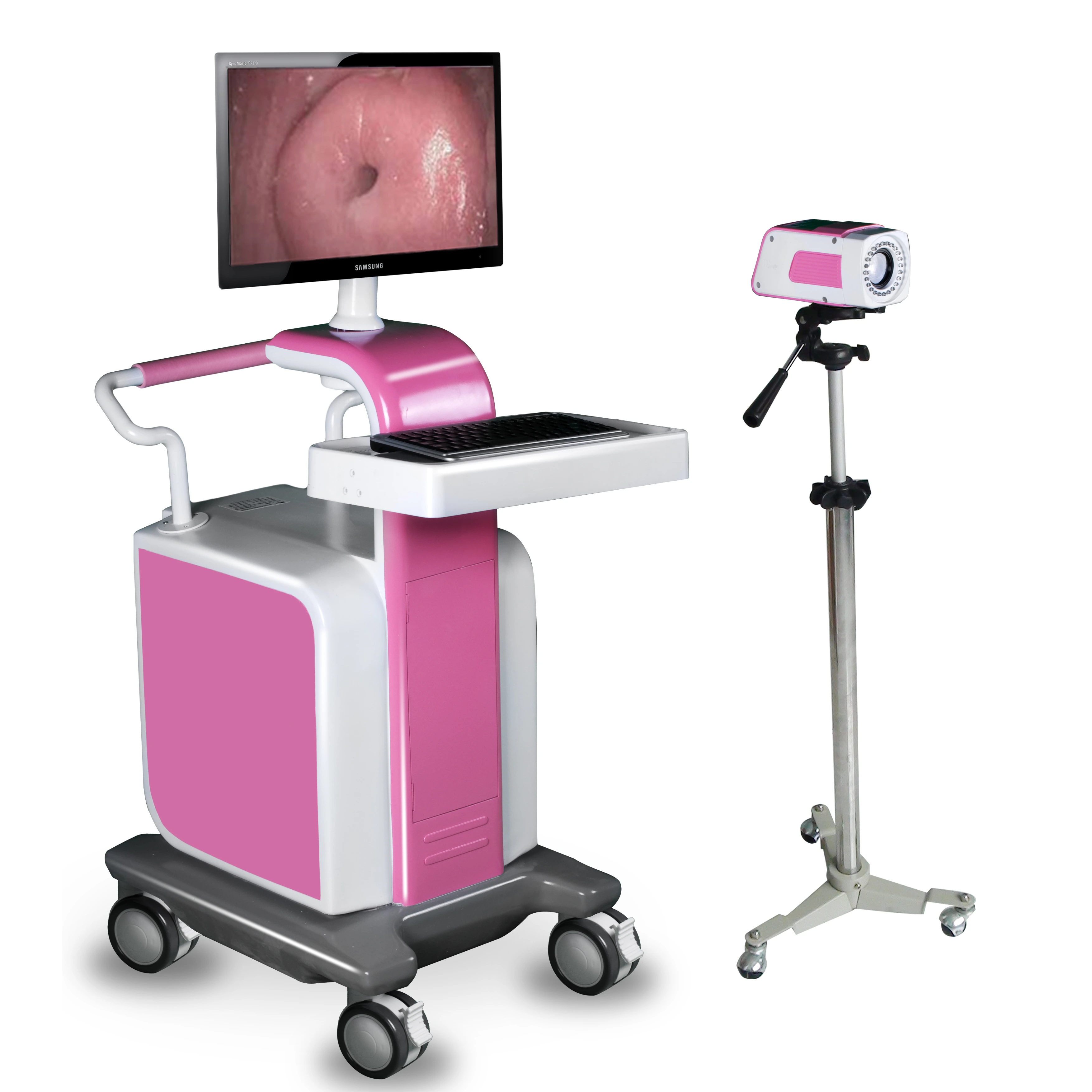 Máquina de carro con cámara óptica HD, software de vídeo para colposcopia vaginal y vídeo digital | INNORKOM 1