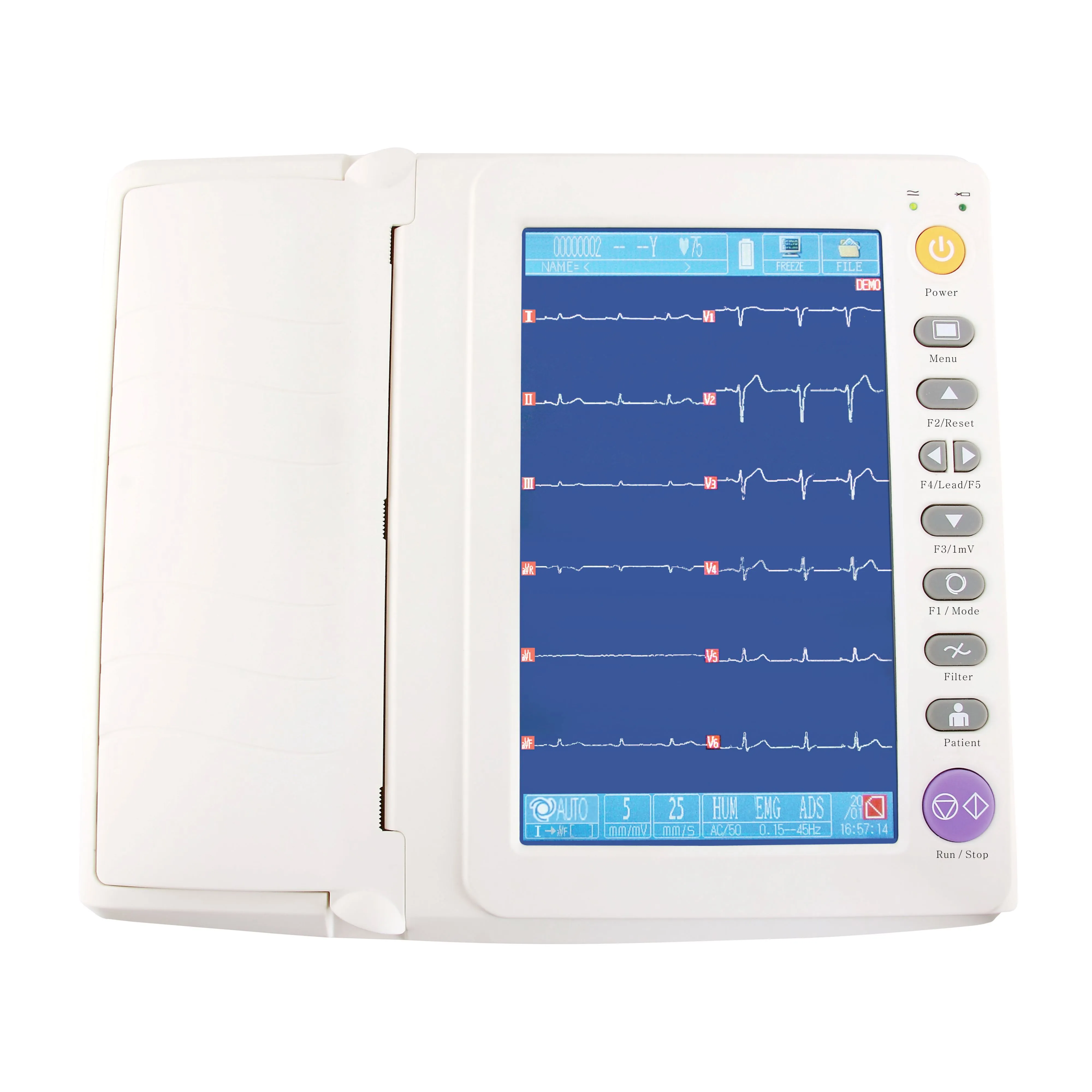 Electrocardiograma ECG, máquina ekg portátil de 12 canales, pantalla táctil digital ecg de 12 derivaciones | INNORKOM 1