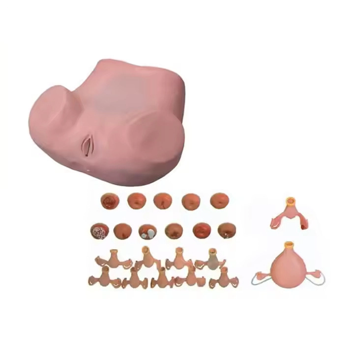 Modelo de exame ginecológico | Innkom 1