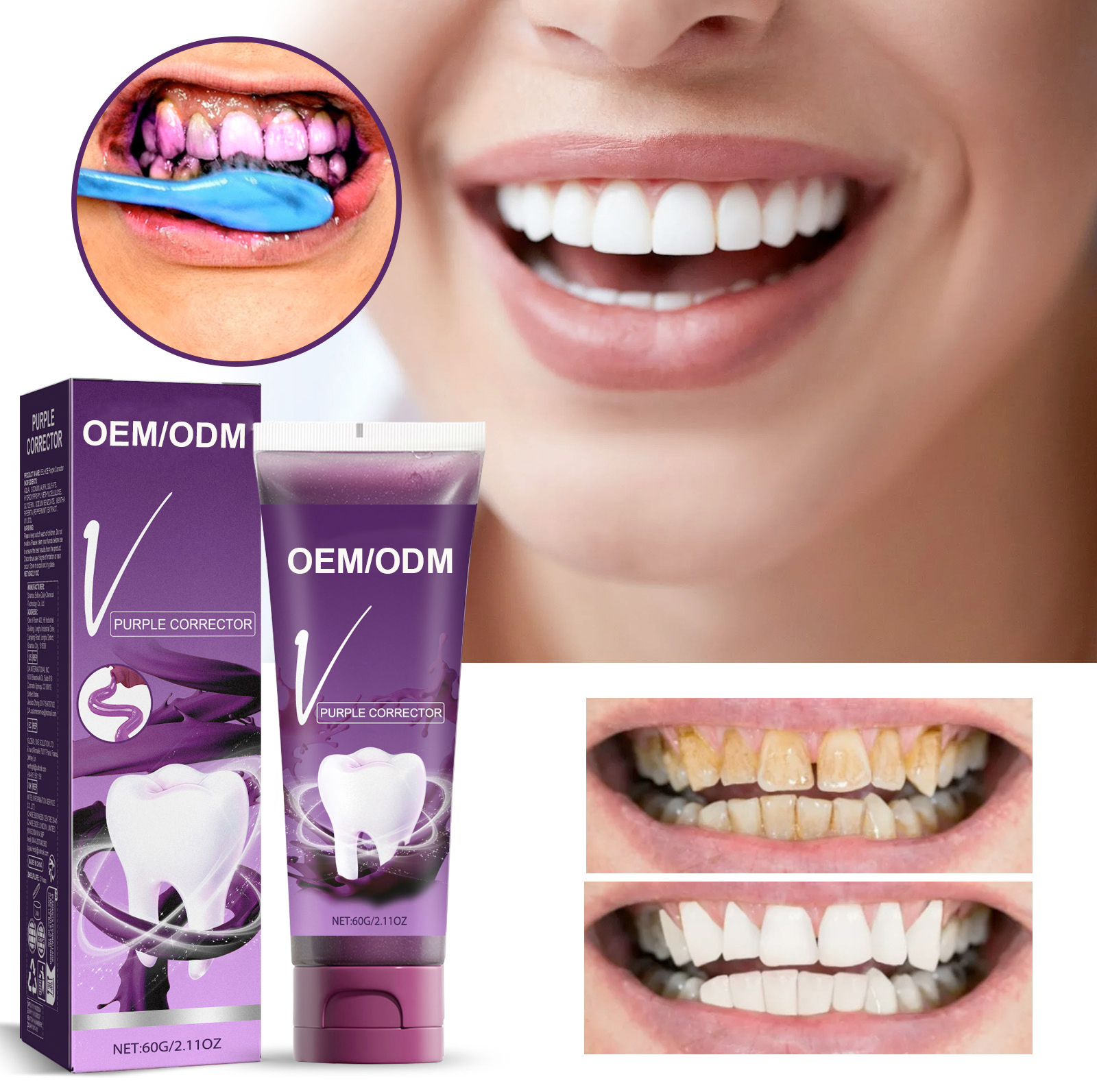 Toothpaste Whitening by Roeasy-1 2
