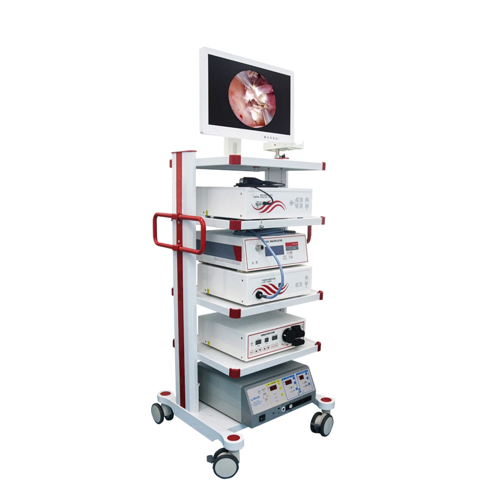 Endoscopio de histeroscopia portátil Conjunto completo para cirugía ginecología | Interno 1