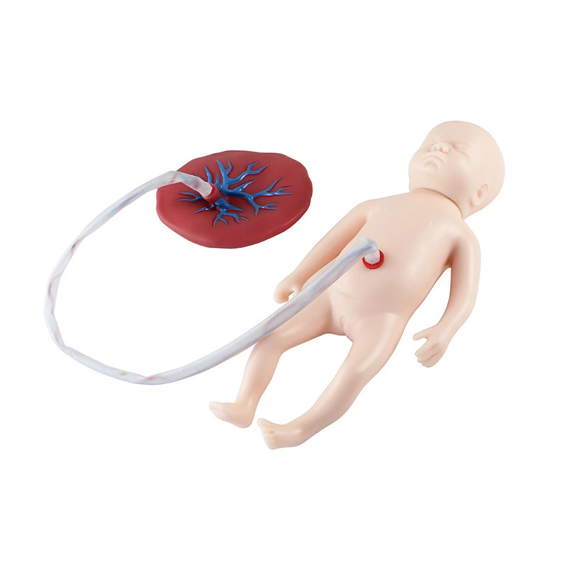 Modelo avançado de enfermagem no cordão umbilical neonato | Innkom 1