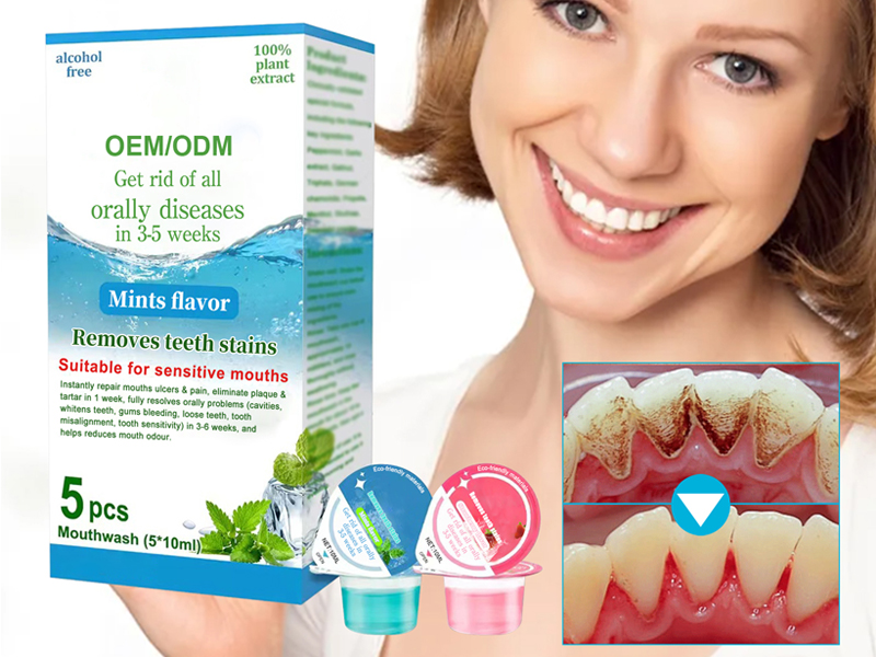 Mints flavor Removes teeth stains Jelly cup mouthwash 3
