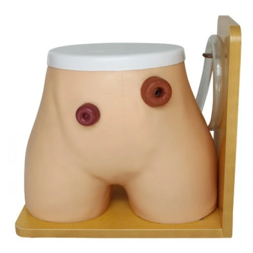 Nursing Training Ostomy Nursing Model | INNORKOM 1