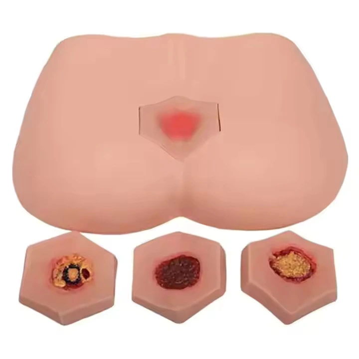 Stage Decubitus Ulcer Care Model | INNORKOM 1