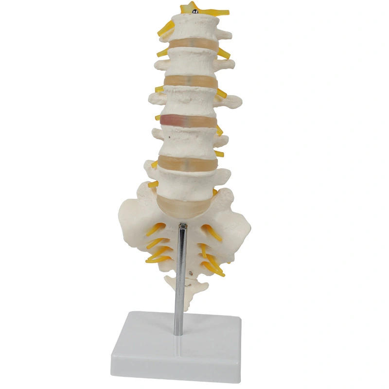 Modelo de vértebra lumbar | INNORKOM 1