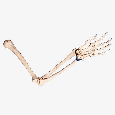 Arm Bone Model | INNORKOM 1