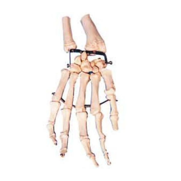 Palm Bone with Elbow-bone and Radial Bone Model | INNORKOM 1
