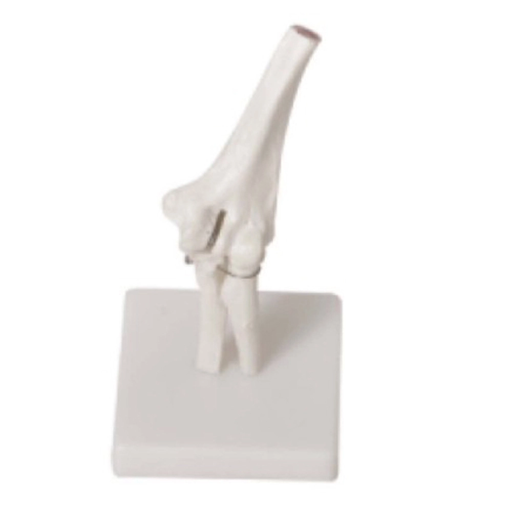 Elbow Joint Model | INNORKOM 1