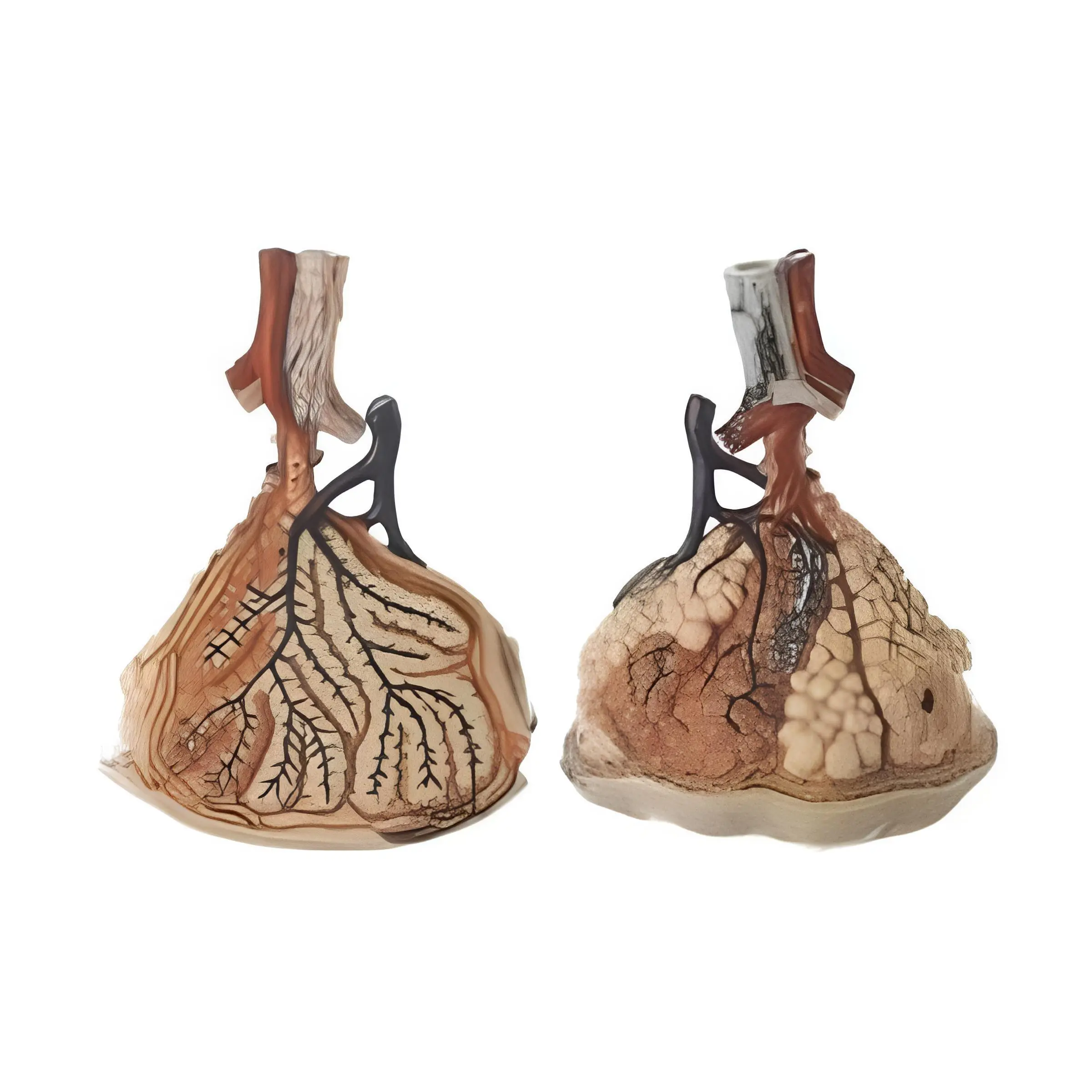 Alveolus Model | INNORKOM 1
