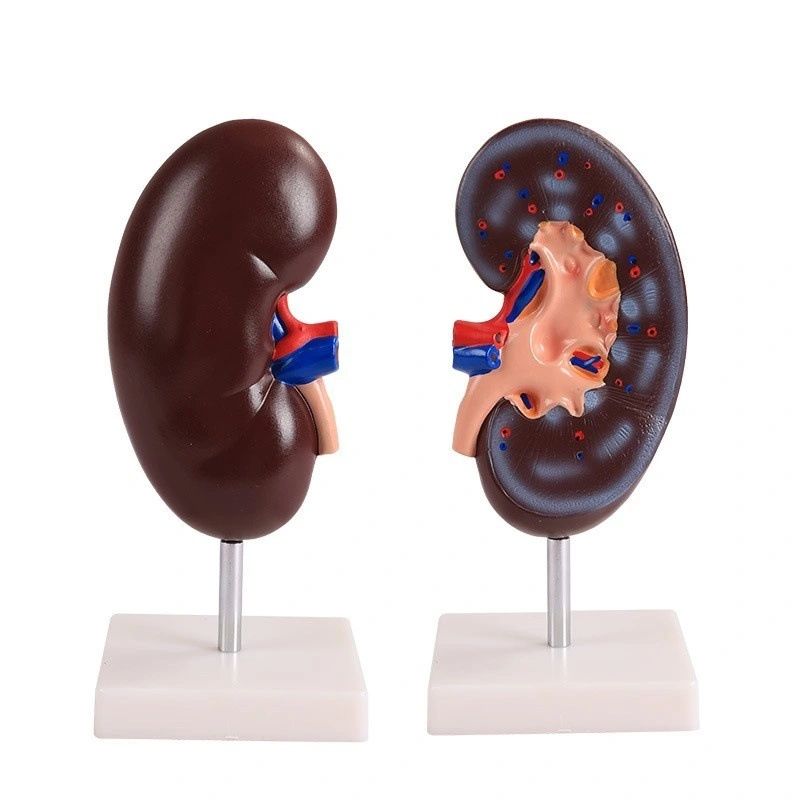 Kidney Model (1 part) | INNORKOM 1