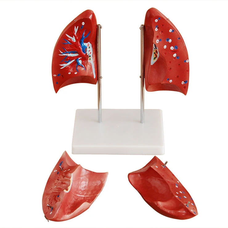 Modelo de anatomía pulmonar | INNORKOM 1