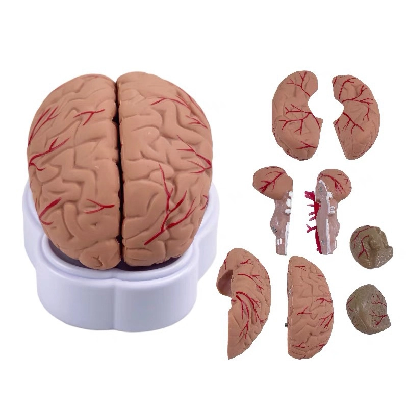 Brain with Arteries 9 Parts | INNORKOM 1