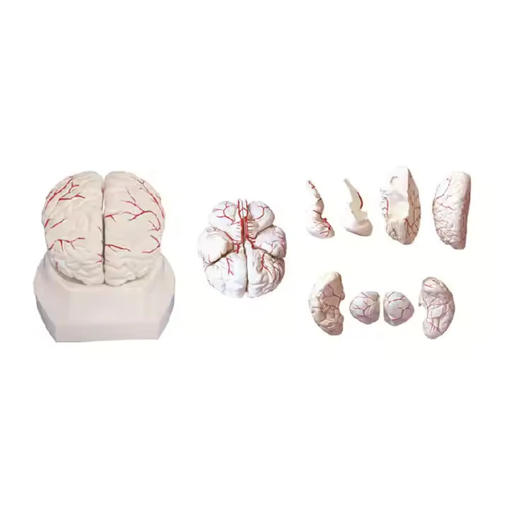 Brain with Arteries Anatomy Model | INNORKOM 1