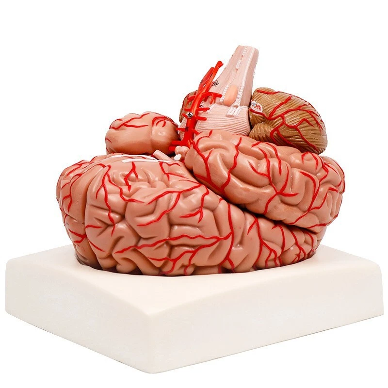 Brain with arteries | INNORKOM 1
