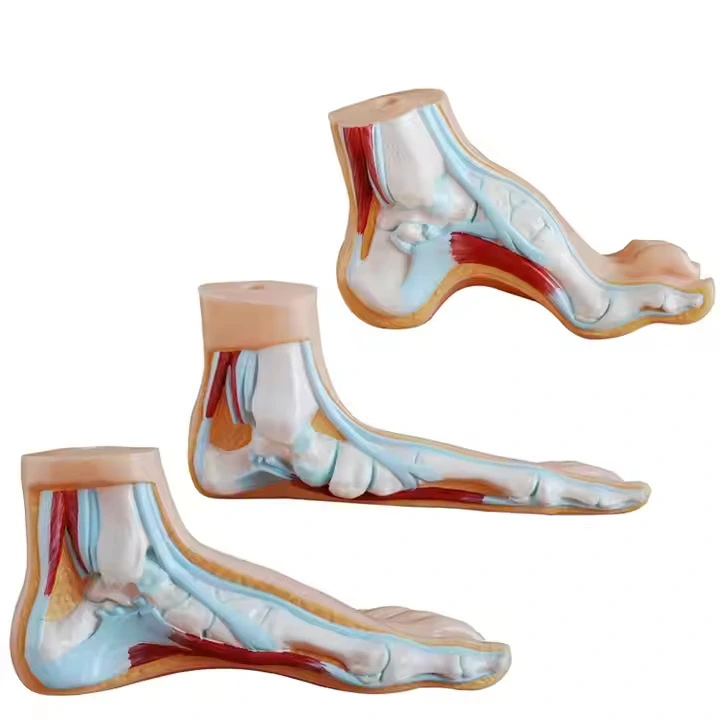 Normal, Flat and Arched Foot | INNORKOM 1