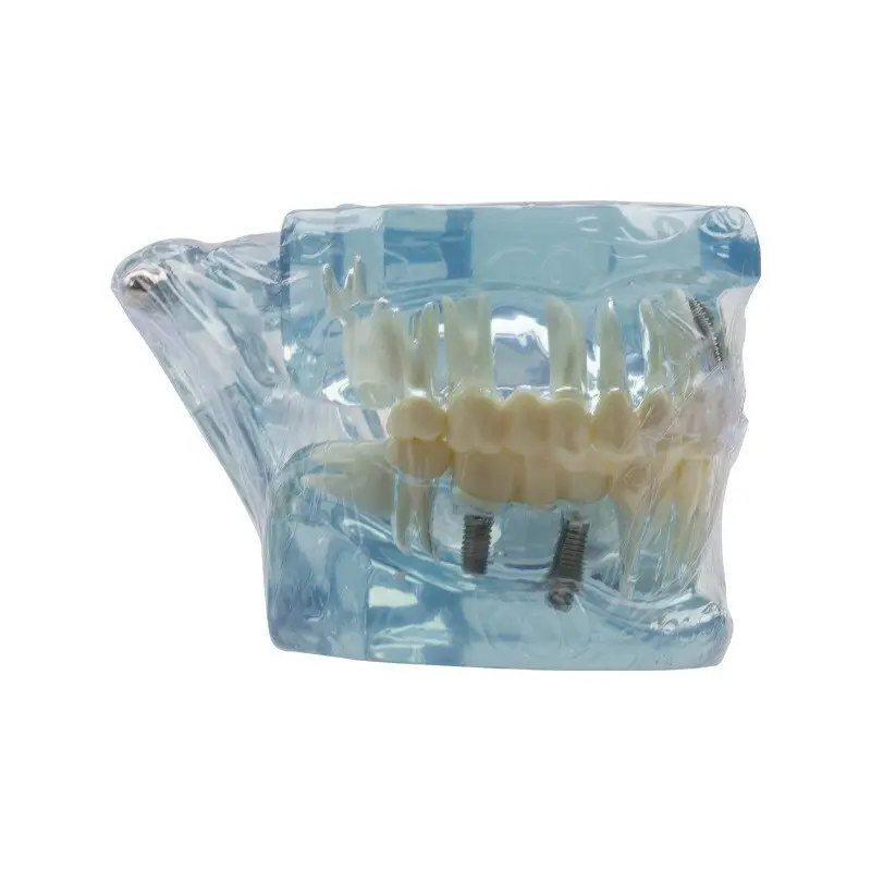 Durable Medical Skull Model Medical Skull Model Company 2