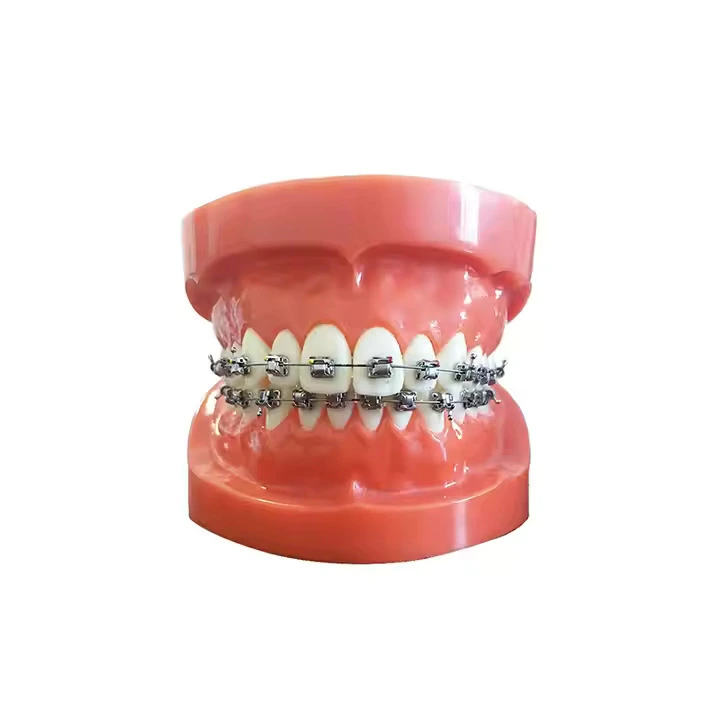 Fixed Remedy Teeth Model (normal) | INNORKOM 1