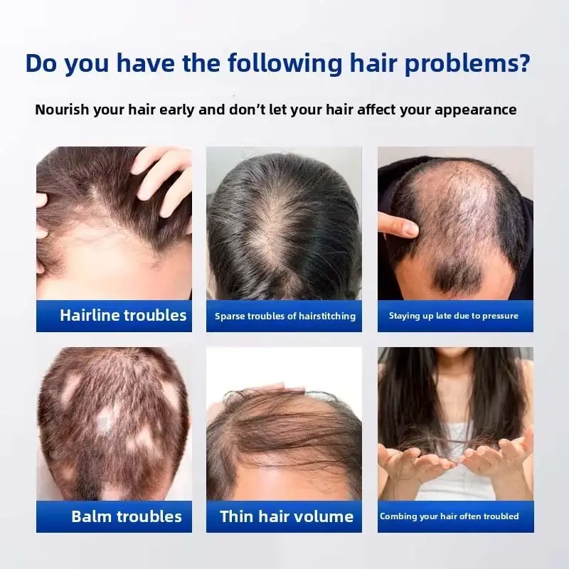 Best Shampoo for Hair - for Wholesale - Triwell 2