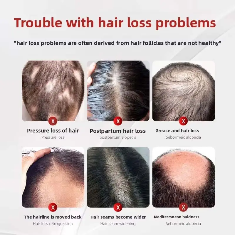 Reliable Dandruff Shampoo Bulk Production 2